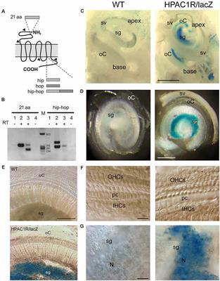 Endogenous Pituitary Adenylate Cyclase-Activating Polypeptide (PACAP) Plays a Protective Effect Against Noise-Induced Hearing Loss